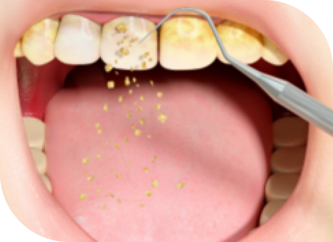 Periodontal Therapy